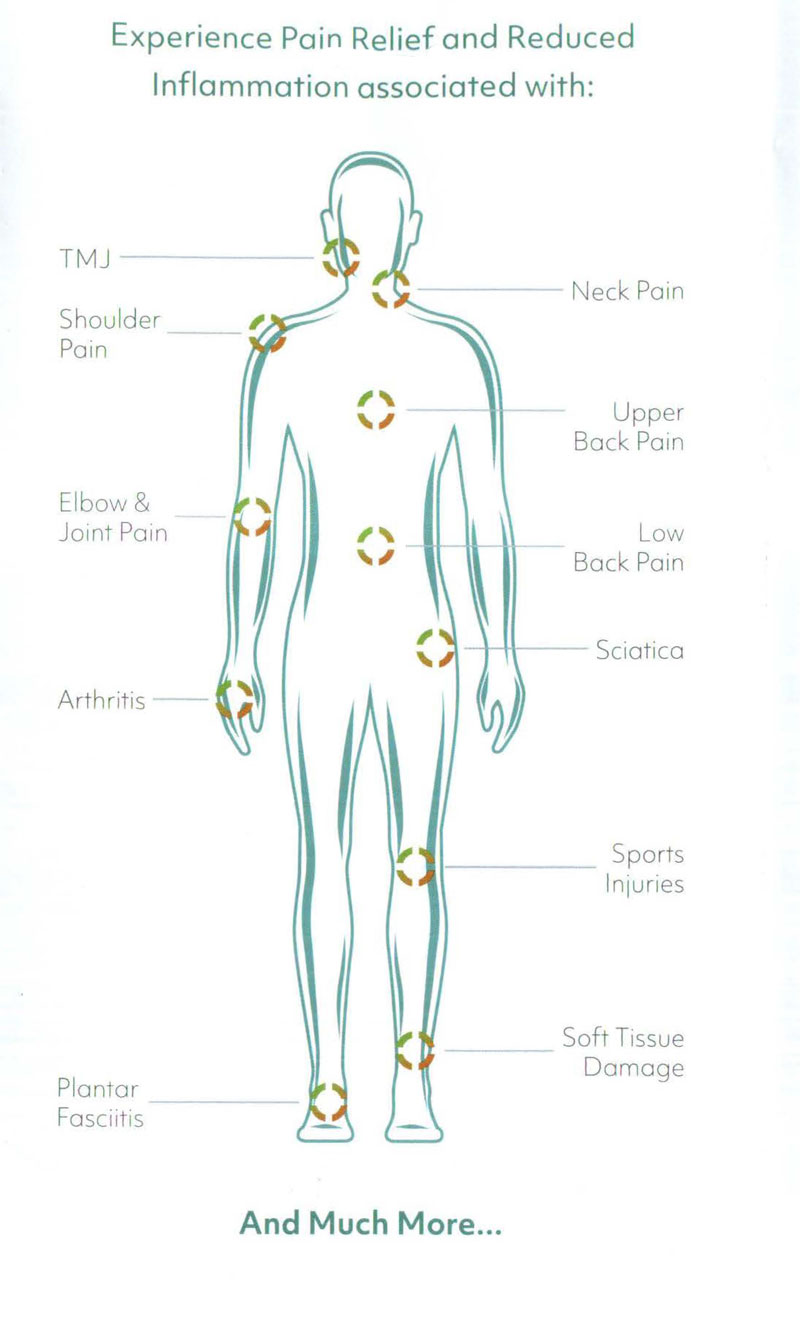 Deep Tissue Laser Therapy: diagram of the body and all the areas deep tissue laser therapy can help